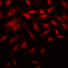 Rabbit Anti-Rab4 Antibody used in Immunocytochemistry/Immunofluorescence (ICC/IF) on Human Heat Shocked Cervical cancer cell line (HeLa) (SPC-141)