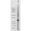 Rabbit Anti-Rab4 Antibody used in Western blot (WB) on Human Cervical cancer cell line (HeLa) lysate (SPC-141)