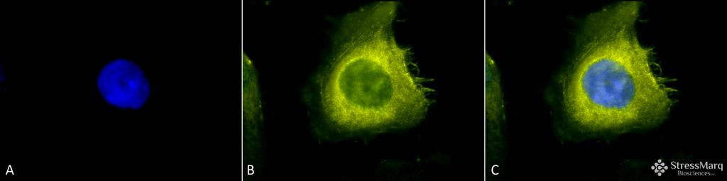 <p>Immunocytochemistry/Immunofluorescence analysis using Rabbit Anti-CDC37 Polyclonal Antibody (SPC-142). Tissue: Heat Shocked Cervical cancer cell line (HeLa). Species: Human. Fixation: 2% Formaldehyde for 20 min at RT. Primary Antibody: Rabbit Anti-CDC37 Polyclonal Antibody (SPC-142) at 1:200 for 12 hours at 4°C. Secondary Antibody: R-PE Goat Anti-Rabbit (yellow) at 1:200 for 2 hours at RT. Counterstain: DAPI (blue) nuclear stain at 1:40000 for 2 hours at RT. Localization: Cytoplasm. Magnification: 100x. (A) DAPI (blue) nuclear stain. (B) Anti-CDC37 Antibody. (C) Composite. Heat Shocked at 42°C for 30 min.</p>
