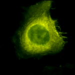 SPC-142_CDC37_Antibody_ICC-IF_Human_Heat-Shocked-HeLa-Cells_100x_Composite.png