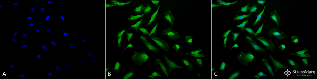 <p>Immunocytochemistry/Immunofluorescence analysis using Rabbit Anti-CDC37 Polyclonal Antibody (SPC-142). Tissue: Heat Shocked Cervical cancer cell line (HeLa). Species: Human. Fixation: 2% Formaldehyde for 20 min at RT. Primary Antibody: Rabbit Anti-CDC37 Polyclonal Antibody (SPC-142) at 1:200 for 12 hours at 4°C. Secondary Antibody: FITC Goat Anti-Rabbit (green) at 1:200 for 2 hours at RT. Counterstain: DAPI (blue) nuclear stain at 1:40000 for 2 hours at RT. Localization: Cytoplasm. Magnification: 20x. (A) DAPI (blue) nuclear stain. (B) Anti-CDC37 Antibody. (C) Composite. Heat Shocked at 42°C for 30 min.</p>
