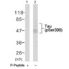 Rabbit Anti-Tau Antibody (pSer396) used in Western blot (WB) on Brain cell lysates (SPC-1436)