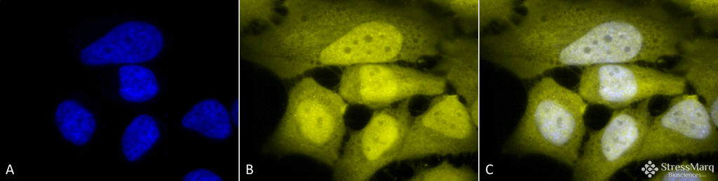 <p>Immunocytochemistry/Immunofluorescence analysis using Rabbit Anti-Phosphoserine Polyclonal Antibody (SPC-149). Tissue: Cervical cancer cell line (HeLa). Species: Human. Fixation: 2% Formaldehyde for 20 min at RT. Primary Antibody: Rabbit Anti-Phosphoserine Polyclonal Antibody (SPC-149) at 1:50 for 12 hours at 4°C. Secondary Antibody: R-PE Goat Anti-Rabbit (yellow) at 1:200 for 2 hours at RT. Counterstain: DAPI (blue) nuclear stain at 1:40000 for 2 hours at RT. Localization: Cytoplasm. Nucleus. Magnification: 100x.</p>
