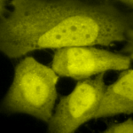 SPC-149_Phosphoserine_Antibody_ICC-IF_Human_HeLa-Cells_100x_Composite2.png