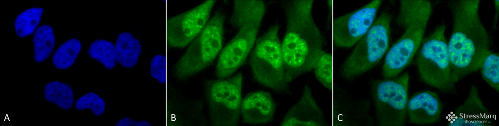 <p>Immunocytochemistry/Immunofluorescence analysis using Rabbit Anti-Phosphothreonine Polyclonal Antibody (SPC-154). Tissue: Cervical cancer cell line (HeLa). Species: Human. Fixation: 2% Formaldehyde for 20 min at RT. Primary Antibody: Rabbit Anti-Phosphothreonine Polyclonal Antibody (SPC-154) at 1:60 for 12 hours at 4°C. Secondary Antibody: FITC Goat Anti-Rabbit (green) at 1:200 for 2 hours at RT. Counterstain: DAPI (blue) nuclear stain at 1:40000 for 2 hours at RT. Localization: Cytoplasm. Nucleus. Magnification: 100x. (A) DAPI (blue) nuclear stain. (B) Anti-Phosphothreonine Antibody. (C) Composite.</p>

