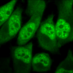 SPC-154_Phosphothreonine_Antibody_ICC-IF_Human_HeLa-Cells_100x_Composite.png