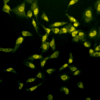 Rabbit Anti-Phosphothreonine Antibody used in Immunocytochemistry/Immunofluorescence (ICC/IF) on Cervical cancer cell line (HeLa) (SPC-154)