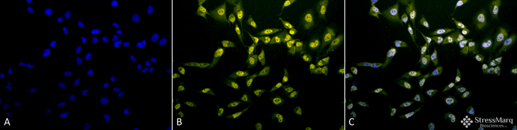 <p>Immunocytochemistry/Immunofluorescence analysis using Rabbit Anti-Phosphothreonine Polyclonal Antibody (SPC-154). Tissue: Cervical cancer cell line (HeLa). Species: Human. Fixation: 2% Formaldehyde for 20 min at RT. Primary Antibody: Rabbit Anti-Phosphothreonine Polyclonal Antibody (SPC-154) at 1:60 for 12 hours at 4°C. Secondary Antibody: R-PE Goat Anti-Rabbit (yellow) at 1:200 for 2 hours at RT. Counterstain: DAPI (blue) nuclear stain at 1:40000 for 2 hours at RT. Localization: Cytoplasm. Nucleus. Magnification: 20x. (A) DAPI (blue) nuclear stain. (B) Anti-Phosphothreonine Antibody. (C) Composite.</p>
