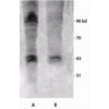 Rabbit Anti-Phosphothreonine Antibody used in Western blot (WB) on brain cell lysates (SPC-154)