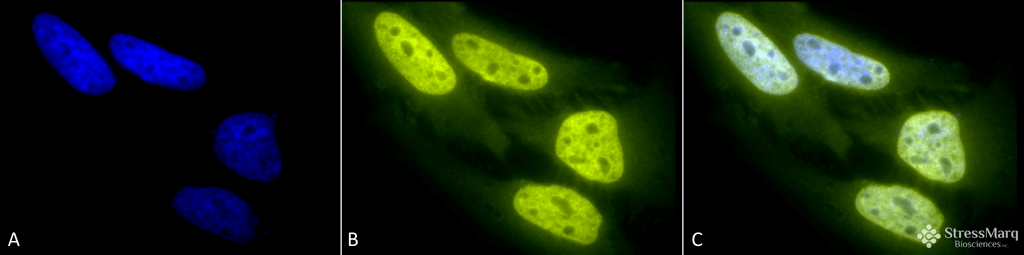 <p>Immunocytochemistry/Immunofluorescence analysis using Rabbit Anti-Acetylated Lysine Polyclonal Antibody (SPC-155). Tissue: Heat Shocked Cervical cancer cell line (HeLa). Species: Human. Fixation: 2% Formaldehyde for 20 min at RT. Primary Antibody: Rabbit Anti-Acetylated Lysine Polyclonal Antibody (SPC-155) at 1:100 for 12 hours at 4°C. Secondary Antibody: R-PE Goat Anti-Rabbit (yellow) at 1:200 for 2 hours at RT. Counterstain: DAPI (blue) nuclear stain at 1:40000 for 2 hours at RT. Localization: Nucleus. Cytoplasm. Magnification: 100x. (A) DAPI (blue) nuclear stain. (B) Anti-Acetylated Lysine Antibody. (C) Composite. Heat Shocked at 42°C for 1h.</p>
