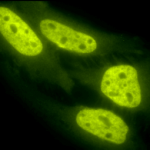 SPC-155_Acetylated-Lysine_Antibody_ICC-IF_Human_Heat-Shocked-HeLa-Cells_100x_Composite.png