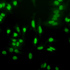 Rabbit Anti-Acetylated Lysine Antibody used in Immunocytochemistry/Immunofluorescence (ICC/IF) on Heat Shocked Cervical cancer cell line (HeLa) (SPC-155)