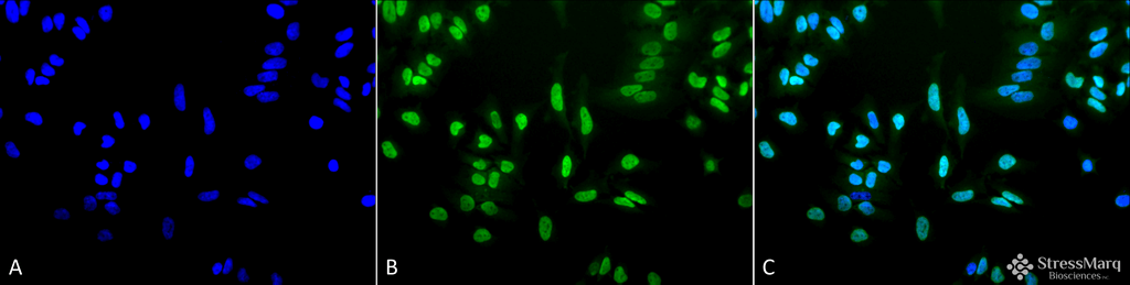 <p>Immunocytochemistry/Immunofluorescence analysis using Rabbit Anti-Acetylated Lysine Polyclonal Antibody (SPC-155). Tissue: Heat Shocked Cervical cancer cell line (HeLa). Species: Human. Fixation: 2% Formaldehyde for 20 min at RT. Primary Antibody: Rabbit Anti-Acetylated Lysine Polyclonal Antibody (SPC-155) at 1:100 for 12 hours at 4°C. Secondary Antibody: FITC Goat Anti-Rabbit (green) at 1:200 for 2 hours at RT. Counterstain: DAPI (blue) nuclear stain at 1:40000 for 2 hours at RT. Localization: Nucleus. Cytoplasm. Magnification: 20x. (A) DAPI (blue) nuclear stain. (B) Anti-Acetylated Lysine Antibody. (C) Composite. Heat Shocked at 42°C for 1h.</p>
