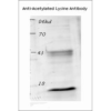 Rabbit Anti-Acetylated Lysine Antibody used in Western blot (WB) on Spleen lysates (SPC-155)