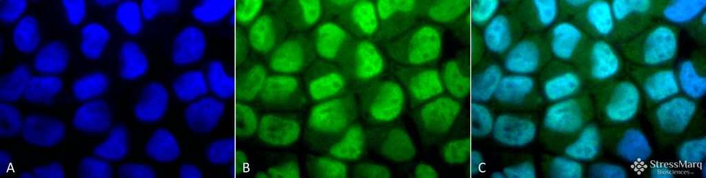 <p>Immunocytochemistry/Immunofluorescence analysis using Rabbit Anti-Methylated Lysine Polyclonal Antibody (SPC-158). Tissue: Cervical cancer cell line (HeLa). Species: Human. Fixation: 2% Formaldehyde for 20 min at RT. Primary Antibody: Rabbit Anti-Methylated Lysine Polyclonal Antibody (SPC-158) at 1:50 for 12 hours at 4°C. Secondary Antibody: FITC Goat Anti-Rabbit (green) at 1:200 for 2 hours at RT. Counterstain: DAPI (blue) nuclear stain at 1:40000 for 2 hours at RT. Localization: Nucleus. Cytoplasm. Magnification: 100x. (A) DAPI (blue) nuclear stain. (B) Anti-Methylated Lysine Antibody. (C) Composite.</p>
