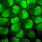 SPC-158_Methylated-Lysine_Antibody_ICC-IF_Human_HeLa-Cells_100x_Composite.png