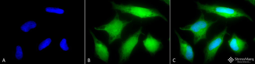 <p>Immunocytochemistry/Immunofluorescence analysis using Rabbit Anti-Rab5 Polyclonal Antibody (SPC-168). Tissue: Cervical cancer cell line (HeLa). Species: Human. Fixation: 2% Formaldehyde for 20 min at RT. Primary Antibody: Rabbit Anti-Rab5 Polyclonal Antibody (SPC-168) at 1:80 for 12 hours at 4°C. Secondary Antibody: R-PE Goat Anti-Rabbit (yellow) at 1:200 for 2 hours at RT. Counterstain: DAPI (blue) nuclear stain at 1:40000 for 2 hours at RT. Localization: Cytoplasm. Melanosome. Nucleus. Magnification: 100x. (A) DAPI (blue) nuclear stain. (B) Anti-Rab5 Antibody. (C) Composite.</p>
