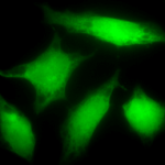 SPC-168_Rab5_Antibody_ICC-IF_Human_HeLa-Cells_100x_Composite.png