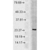 Rabbit Anti-Rab5 Antibody used in Western blot (WB) on Cell line lysates (SPC-168)