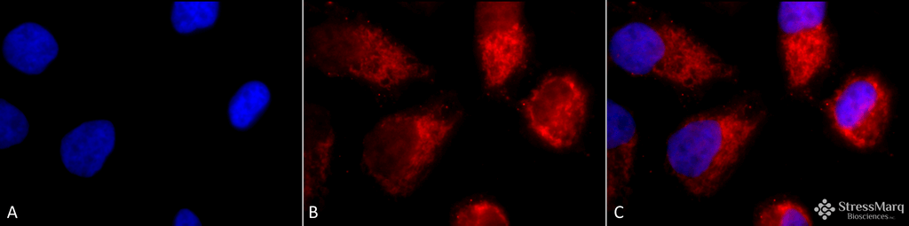 <p>Immunocytochemistry/Immunofluorescence analysis using Rabbit Anti-TNF-R1 Polyclonal Antibody (SPC-170). Tissue: Cervical cancer cell line (HeLa). Species: Human. Fixation: 2% Formaldehyde for 20 min at RT. Primary Antibody: Rabbit Anti-TNF-R1 Polyclonal Antibody (SPC-170) at 1:100 for 12 hours at 4°C. Secondary Antibody: APC Goat Anti-Rabbit (red) at 1:200 for 2 hours at RT. Counterstain: DAPI (blue) nuclear stain at 1:40000 for 2 hours at RT. Localization: Golgi apparatus membrane. Magnification: 100x. (A) DAPI (blue) nuclear stain. (B) Anti-TNF-R1 Antibody. (C) Composite.</p>
