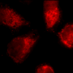 SPC-170_TNF-R1_Antibody_ICC-IF_Human_HeLa-Cells_100x_Composite.png