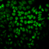 Rabbit Anti-TNF-R1 Antibody used in Immunocytochemistry/Immunofluorescence (ICC/IF) on Cervical cancer cell line (HeLa) (SPC-170)