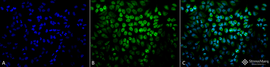 <p>Immunocytochemistry/Immunofluorescence analysis using Rabbit Anti-TNF-R1 Polyclonal Antibody (SPC-170). Tissue: Cervical cancer cell line (HeLa). Species: Human. Fixation: 2% Formaldehyde for 20 min at RT. Primary Antibody: Rabbit Anti-TNF-R1 Polyclonal Antibody (SPC-170) at 1:100 for 12 hours at 4°C. Secondary Antibody: FITC Goat Anti-Rabbit (green) at 1:200 for 2 hours at RT. Counterstain: DAPI (blue) nuclear stain at 1:40000 for 2 hours at RT. Localization: Golgi apparatus membrane. Magnification: 20x. (A) DAPI (blue) nuclear stain. (B) Anti-TNF-R1 Antibody. (C) Composite.</p>
