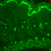 Rabbit Anti-TNF-R1 Antibody used in Immunohistochemistry (IHC) on backskin (SPC-170)