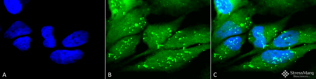 <p>Immunocytochemistry/Immunofluorescence analysis using Rabbit Anti-p38 Polyclonal Antibody (SPC-172). Tissue: Cervical cancer cell line (HeLa). Species: Human. Fixation: 2% Formaldehyde for 20 min at RT. Primary Antibody: Rabbit Anti-p38 Polyclonal Antibody (SPC-172) at 1:100 for 12 hours at 4°C. Secondary Antibody: FITC Goat Anti-Rabbit (green) at 1:200 for 2 hours at RT. Counterstain: DAPI (blue) nuclear stain at 1:40000 for 2 hours at RT. Localization: Mitochondrion. Cytoplasm. Nucleus. Magnification: 100x. (A) DAPI (blue) nuclear stain. (B) Anti-p38 Antibody. (C) Composite.</p>
