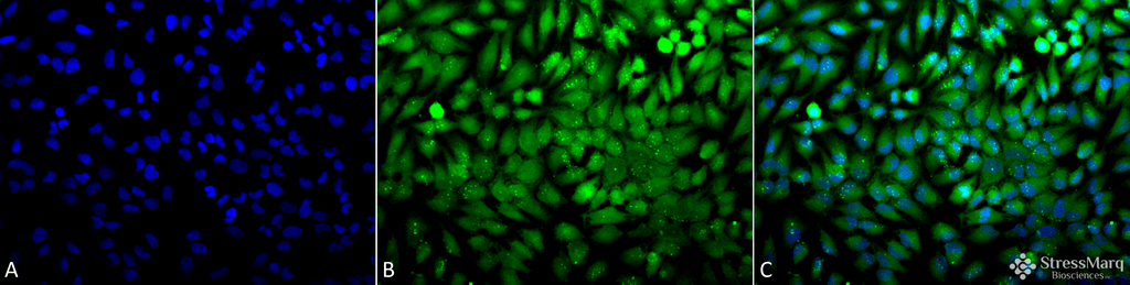 <p>Immunocytochemistry/Immunofluorescence analysis using Rabbit Anti-p38 Polyclonal Antibody (SPC-172). Tissue: Cervical cancer cell line (HeLa). Species: Human. Fixation: 2% Formaldehyde for 20 min at RT. Primary Antibody: Rabbit Anti-p38 Polyclonal Antibody (SPC-172) at 1:100 for 12 hours at 4°C. Secondary Antibody: FITC Goat Anti-Rabbit (green) at 1:200 for 2 hours at RT. Counterstain: DAPI (blue) nuclear stain at 1:40000 for 2 hours at RT. Localization: Mitochondrion. Cytoplasm. Nucleus. Magnification: 20x. (A) DAPI (blue) nuclear stain. (B) Anti-p38 Antibody. (C) Composite.</p>
