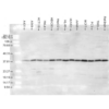 Rabbit Anti-p38 Antibody used in Western blot (WB) on cancer cell lines (SPC-172)