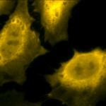SPC-178_Hsp70_Antibody_ICC-IF_Human_Heat-Shocked-HeLa-Cells_100x_Composite.png
