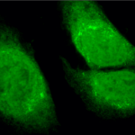 SPC-180_GRP78-Bip_Antibody_ICC-IF_Human_Heat-Shocked-HeLa-Cells_100x_Composite.png