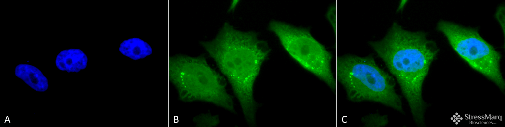 <p>Immunocytochemistry/Immunofluorescence analysis using Rabbit Anti-Calnexin-CT Polyclonal Antibody (SPC-182). Tissue: Heat Shocked Cervical cancer cell line (HeLa). Species: Human. Fixation: 2% Formaldehyde for 20 min at RT. Primary Antibody: Rabbit Anti-Calnexin-CT Polyclonal Antibody (SPC-182) at 1:80 for 12 hours at 4°C. Secondary Antibody: FITC Goat Anti-Rabbit (green) at 1:200 for 2 hours at RT. Counterstain: DAPI (blue) nuclear stain at 1:40000 for 2 hours at RT. Localization: Endoplasmic reticulum membrane. Melanosome. Magnification: 100x. Heat Shocked at 42°C for 1h.</p>
