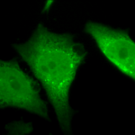 SPC-182_Calnexin-CT_Antibody_ICC-IF_Human_Heat-Shocked-HeLa-Cells_100x_Composite2.png