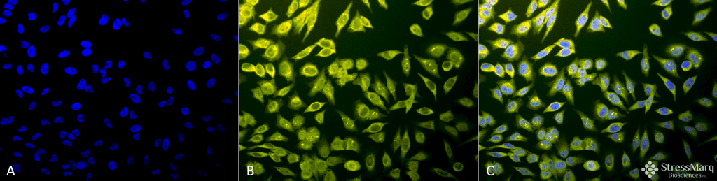 <p>Immunocytochemistry/Immunofluorescence analysis using Rabbit Anti-Calnexin-CT Polyclonal Antibody (SPC-182). Tissue: Heat Shocked Cervical cancer cell line (HeLa). Species: Human. Fixation: 2% Formaldehyde for 20 min at RT. Primary Antibody: Rabbit Anti-Calnexin-CT Polyclonal Antibody (SPC-182) at 1:80 for 12 hours at 4°C. Secondary Antibody: R-PE Goat Anti-Rabbit (yellow) at 1:200 for 2 hours at RT. Counterstain: DAPI (blue) nuclear stain at 1:40000 for 2 hours at RT. Localization: Endoplasmic reticulum membrane. Melanosome. Magnification: 20x. (A) DAPI (blue) nuclear stain. (B) Anti-Calnexin-CT Antibody. (C) Composite. Heat Shocked at 42°C for 1h.</p>
