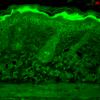 Rabbit Anti-Calnexin-CT Antibody used in Immunohistochemistry (IHC) on backskin (SPC-182)