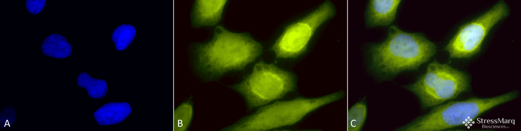 <p>Immunocytochemistry/Immunofluorescence analysis using Rabbit Anti-AHA1 Polyclonal Antibody (SPC-183). Tissue: Heat Shocked Cervical cancer cell line (HeLa). Species: Human. Fixation: 2% Formaldehyde for 20 min at RT. Primary Antibody: Rabbit Anti-AHA1 Polyclonal Antibody (SPC-183) at 1:60 for 12 hours at 4°C. Secondary Antibody: R-PE Goat Anti-Rabbit (yellow) at 1:200 for 2 hours at RT. Counterstain: DAPI (blue) nuclear stain at 1:40000 for 2 hours at RT. Localization: Cytoplasm. Endoplasmic reticulum. Magnification: 100x. (A) DAPI (blue) nuclear stain. (B) Anti-AHA1 Antibody. (C) Composite. Heat Shocked at 42°C for 1h.</p>
