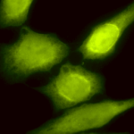 SPC-183_AHA1_Antibody_ICC-IF_Human_Heat-Shocked-HeLa-Cells_100x_Composite.png