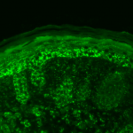 SPC-193_Cpn10_Antibody_IHC_Mouse_backskin_1.png