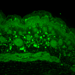 SPC-195_HSP110_Antibody_IHC_Mouse_backskin_1.png