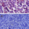 Rabbit Anti-TLR4 Antibody used in Immunohistochemistry (IHC) on Spleen tissue (SPC-200)