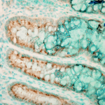 SPC-200_TLR4_Antibody_IHC_Mouse_colon-colitis_1.png