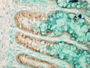 Rabbit Anti-TLR4 Antibody used in Immunohistochemistry (IHC) on colon colitis (SPC-200)