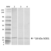 Rabbit Anti-SOD1 (UBB) Antibody used in Western blot (WB) on Hela cells, Brain, Lung (SPC-205)