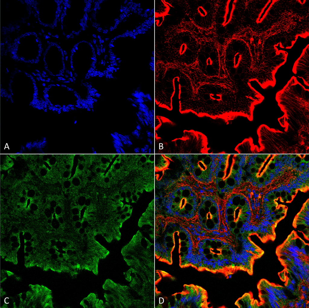 <p>Immunohistochemistry analysis using Rabbit Anti-NHE3 Polyclonal Antibody (SPC-400). Tissue: Colon. Species: Rat. Fixation: Formalin Fixed Paraffin-Embedded. Primary Antibody: Rabbit Anti-NHE3 Polyclonal Antibody (SPC-400) at 1:25 for 1 hour at RT. Secondary Antibody: Goat Anti-Rabbit IgG:Alexa Fluor 488. Counterstain: Actin-binding Phalloidin-Alexa Fluor 633; DAPI (blue) nuclear stain. Magnification: 63X.  (A) DAPI (blue) nuclear stain. (B) Phalloidin Alex Fluor 633 F-Actin stain. (C) NHE3 Antibody (D) Composite</p>
