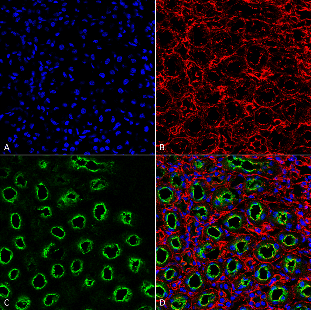 <p>Immunohistochemistry analysis using Rabbit Anti-NKCC2 Polyclonal Antibody (SPC-401). Tissue: Kidney. Species: Rat. Fixation: Formalin Fixed Paraffin-Embedded. Primary Antibody: Rabbit Anti-NKCC2 Polyclonal Antibody (SPC-401) at 1:25 for 1 hour at RT. Secondary Antibody: Goat Anti-Rabbit IgG: Alexa Fluor 488. Counterstain: Actin-binding Phalloidin-Alexa Fluor 633; DAPI (blue) nuclear stain. Magnification: 63X. (A) DAPI (blue) nuclear stain. (B) Phalloidin Alex Fluor 633 F-Actin stain. (C) NKCC2 Antibody (D) Composite</p>
