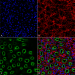 SPC-401_NKCC2_Antibody_IHC_Rat_Kidney_63X_Composite-1.png