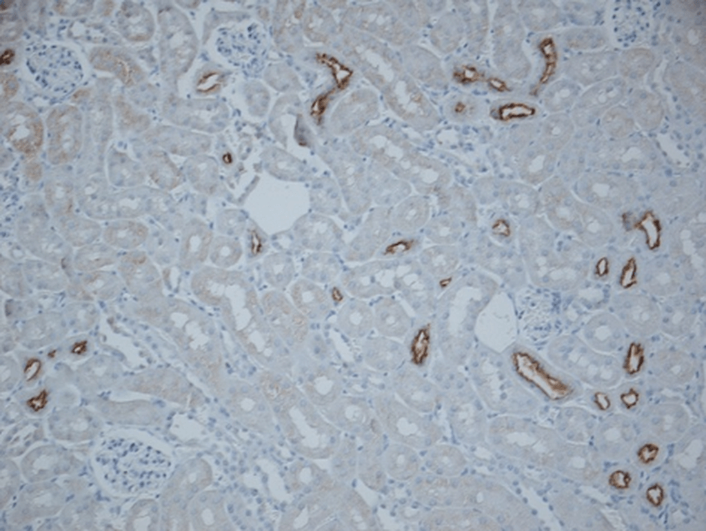 <p>Immunohistochemistry analysis using Rabbit Anti-NCC Polyclonal Antibody (SPC-402). Tissue: kidney tissue. Species: Mouse. Fixation: paraformaldehyde-fixed paraffin-embedded. Primary Antibody: Rabbit Anti-NCC Polyclonal Antibody (SPC-402) at 1:500 for Overnight at 4°C . Secondary Antibody: Biotinylated Goat Anti-Rabbit IgG at 1:500 for 30 min at RT. Courtesy of: Brigitte Rogge.</p>
