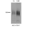 Rabbit Anti-NCC Antibody used in Western blot (WB) on tissue lysates (SPC-402)
